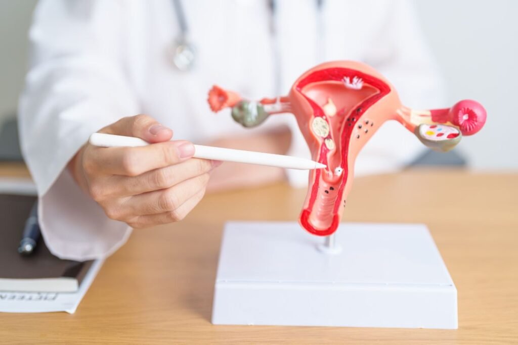 Ovarian cancer